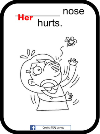 ________ nose
hurts.
Her