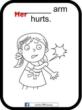 ________ arm
hurts.
Her