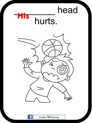 ________ head
hurts.
His