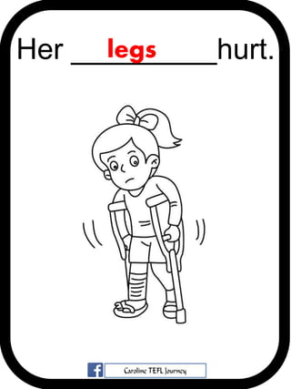 Her _________hurt.legs