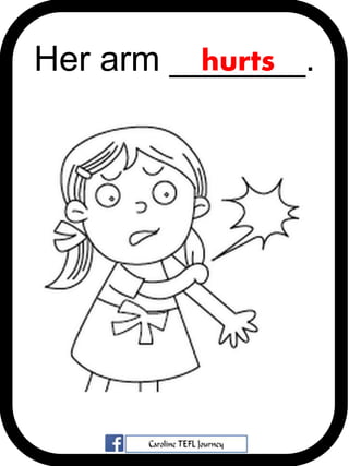 Her arm _______.hurts