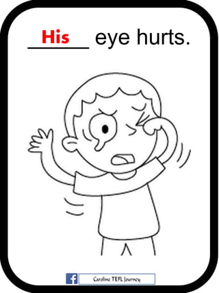 _____ eye hurts.His