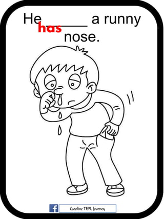 He _____ a runny
nose.
has