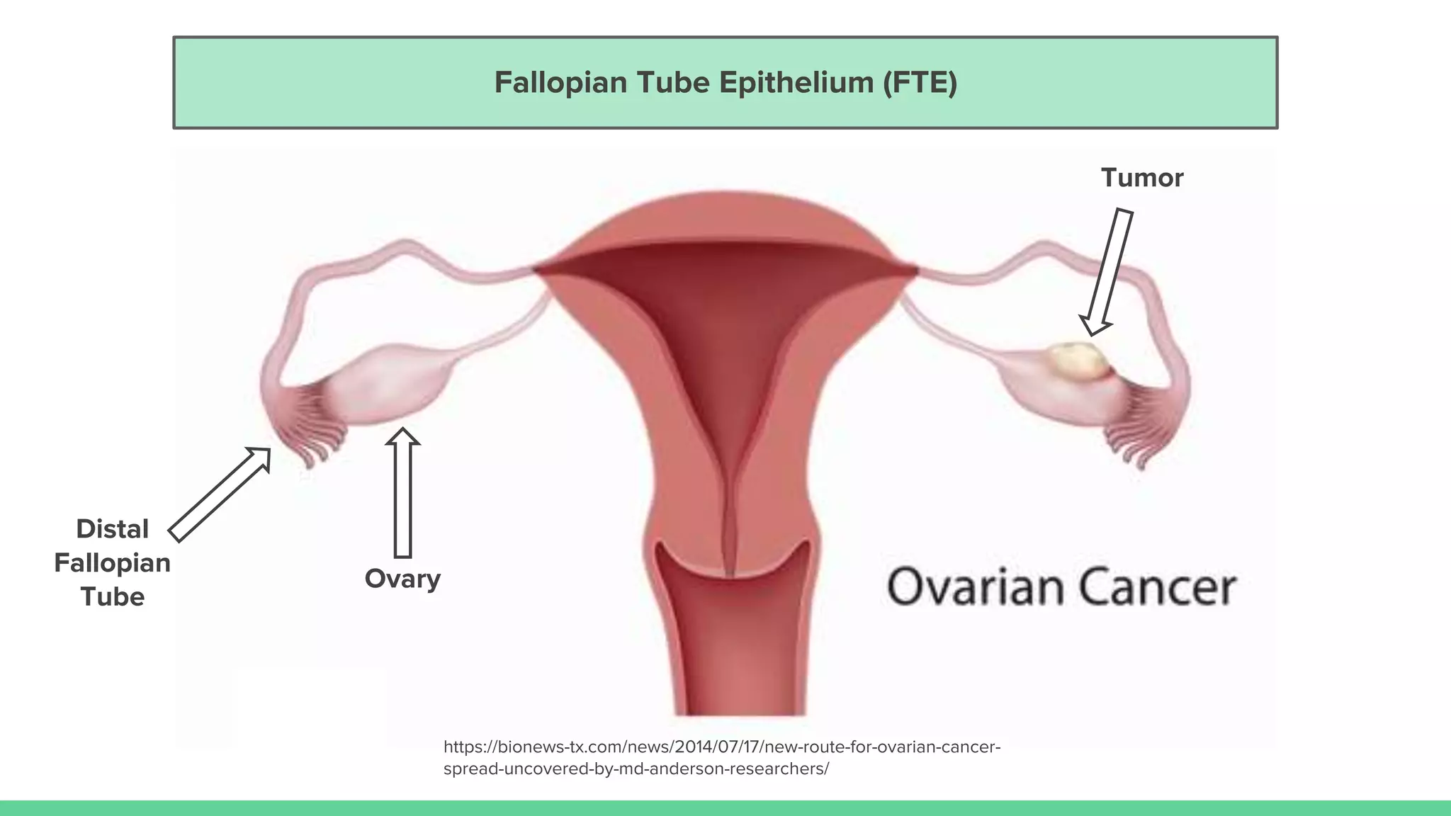 Ovary
Distal
Fallopian
Tube
Tumor
https://bionews-tx.com/news/2014/07/17/new-route-for-ovarian-cancer-
spread-uncovered-by-md-anderson-researchers/
Ovary
Fallopian Tube Epithelium (FTE)
 