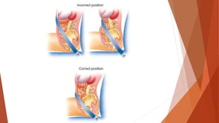 Chest, Abdominal and Genitourinary Injuries | PDF