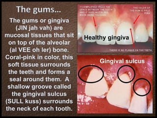 The gums…
The gums or gingiva
(JIN jah vah) are
mucosal tissues that sit
on top of the alveolar
(al VEE oh ler) bone.
Coral-pink in color, this
soft tissue surrounds
the teeth and forms a
seal around them. A
shallow groove called
the gingival sulcus
(SULL kuss) surrounds
the neck of each tooth.
Gingival sulcus
Healthy gingiva
 