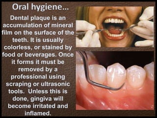 Oral hygiene…
Dental plaque is an
accumulation of mineral
film on the surface of the
teeth. It is usually
colorless, or stained by
food or beverages. Once
it forms it must be
removed by a
professional using
scraping or ultrasonic
tools. Unless this is
done, gingiva will
become irritated and
inflamed.
 