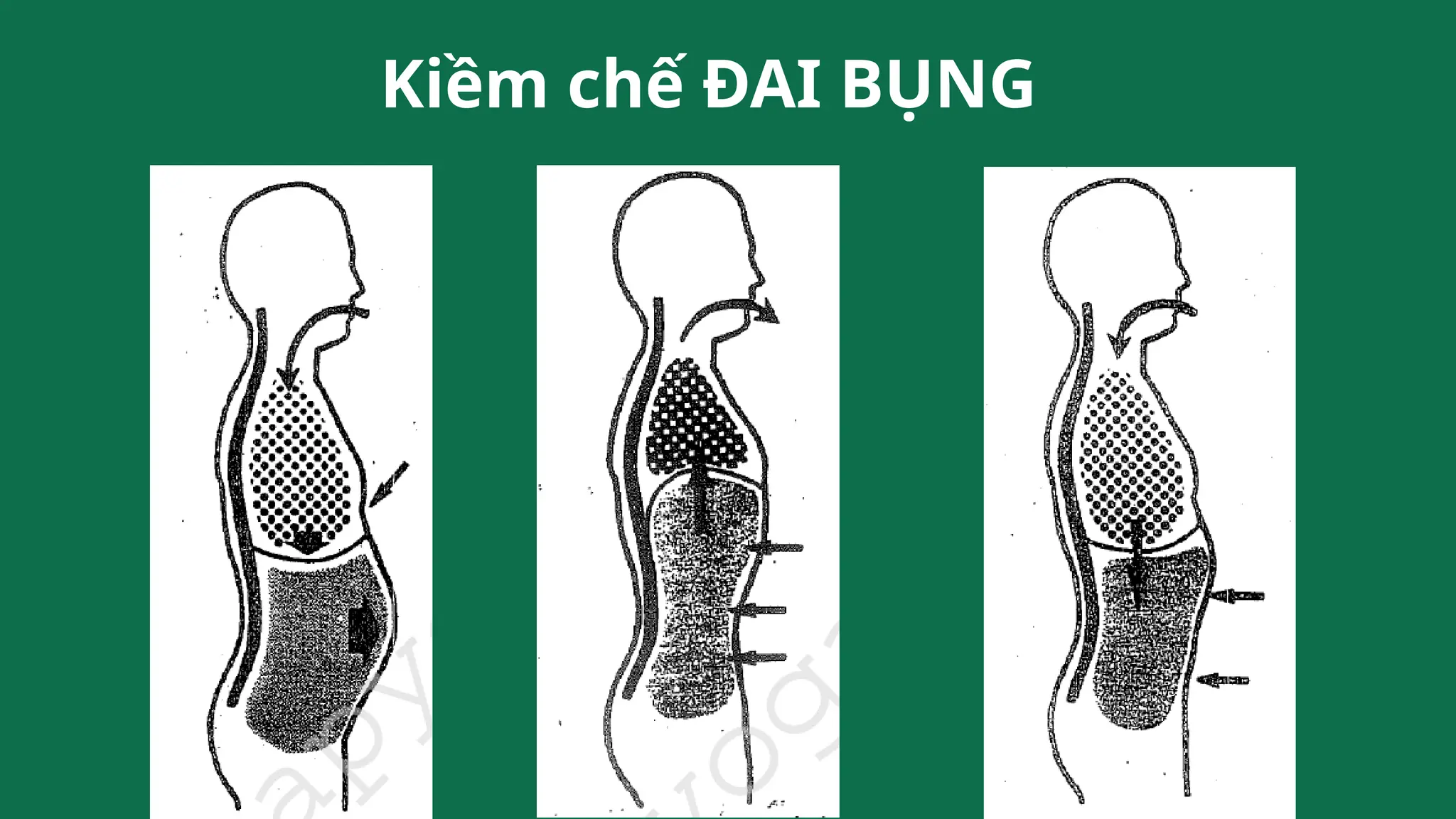 Kiềm chế ĐAI BỤNG
 