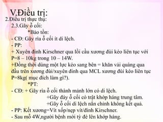 V.Điều trị:

2.Điều trị thực thụ:
2.3.Gãy ỗ cối:
*Bảo tồn:
- CĐ: Gãy rìa ỗ cối ít di lệch.
- PP:
+ Xuyên đinh Kirschner qua lồi cầu xương đùi kéo liên tục với
P=8 – 10kg trong 10 – 14W.
+Đồng thời dùng một lực kéo sang bên = khăn vải quàng qua
đầu trên xương đùi/xuyên đinh qua MCL xương đùi kéo liên tục
P=8kg( mục đích làm gì?).
*PT:
- CĐ: + Gãy rìa ỗ cối thành mảnh lớn có di lệch.
+Gãy đáy ỗ cối có trật khớp háng trung tâm.
+Gãy ỗ cối di lệch nắn chỉnh không kết quả.
- PP: Kết xương=Vít xốp/nẹp vít/đinh Kirschner.
- Sau mỗ 4W,người bệnh mới tỳ đè lên khớp háng.

 