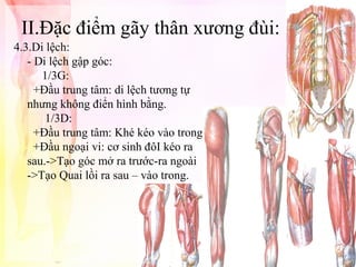 II.Đặc điểm gãy thân xương đùi:
4.3.Di lệch:
- Di lệch gập góc:
1/3G:
+Đầu trung tâm: di lệch tương tự
nhưng không điển hình bằng.
1/3D:
+Đầu trung tâm: Khé kéo vào trong.
+Đầu ngoại vi: cơ sinh đôI kéo ra
sau.->Tạo góc mở ra trước-ra ngoài
->Tạo Quai lồi ra sau – vào trong.

 