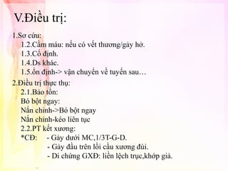 V.Điều trị:
1.Sơ cứu:
1.2.Cầm máu: nếu có vết thương/gảy hở.
1.3.Cố định.
1.4.Ds khác.
1.5.ổn định-> vận chuyển về tuyến sau…
2.Điều trị thực thụ:
2.1.Bảo tồn:
Bó bột ngay:
Nắn chỉnh->Bó bột ngay
Nắn chỉnh-kéo liên tục
2.2.PT kết xương:
*CĐ: - Gảy dưới MC,1/3T-G-D.
- Gảy đầu trên lồi cầu xương đùi.
- Di chứng GXĐ: liền lệch trục,khớp giả.

 