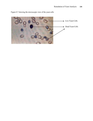 Retardation of Yeast Autolysis 134
Figure 8.7 showing the microscopic view of the yeast cells
Live Yeast Cells
Dead Yeast Cells
 