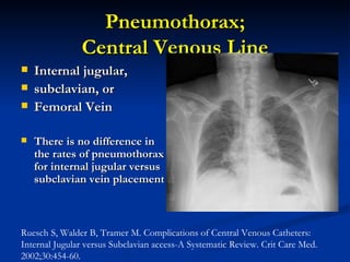 Pneumothorax; Central Venous Line Internal jugular,  subclavian, or  Femoral Vein There is no difference in the rates of pneumothorax for internal jugular versus subclavian vein placement   Ruesch S, Walder B, Tramer M. Complications of Central Venous Catheters: Internal Jugular versus Subclavian access-A Systematic Review. Crit Care Med. 2002;30:454-60.   