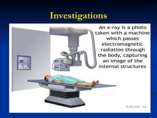 Investigations A A A A A 