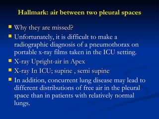 Hallmark: air between two pleural spaces Why they are missed?  Unfortunately, it is difficult to make a radiographic diagnosis of a pneumothorax on portable x-ray films taken in the ICU setting. X-ray Upright-air in Apex X-ray In ICU; supine , semi supine  In addition, concurrent lung disease may lead to different distributions of free air in the pleural space than in patients with relatively normal lungs. 