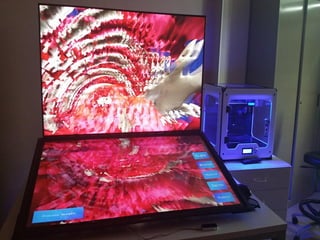 #HOLODECK4D
‘HoloDeck’ is a 4D immersive visualization system to improve the
accuracy, speed and efficiency for clinical diagnosis in Nuclear
Medicine. This system integrates a workbench that generates
interactive and gesturally operable 3D models, based on the
two-dimensional images coming from the existing PET/TC
systems. This prototype, totally functional, is a collaborative R&D
project developed between CreativiTIC and CIBIR (Center for
Biomedical Research of La Rioja - Rioja Health Foundation).
 