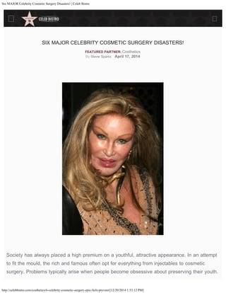 Six MAJOR Celebrity Cosmetic Surgery Disasters! | Celeb Bistro
http://celebbistro.com/costhetics/6-celebrity-cosmetic-surgery-epic-fails-prevent/[12/20/2014 1:53:12 PM]
SIX MAJOR CELEBRITY COSMETIC SURGERY DISASTERS!
FEATURED PARTNER: Costhetics
By Stevie Sparks April 17, 2014
 
Society has always placed a high premium on a youthful, attractive appearance. In an attempt
to fit the mould, the rich and famous often opt for everything from injectables to cosmetic
surgery. Problems typically arise when people become obsessive about preserving their youth.
 
 