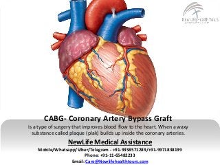 CABG- Coronary Artery Bypass Graft
is a type of surgery that improves blood flow to the heart. When a waxy
substance called plaque (plak) builds up inside the coronary arteries.
NewLife Medical Assistance
Mobile/Whatsapp/Viber/Telegram - +91-9358571289/+91-9971838199
Phone: +91-11-65482233
Email: Care@Newlifehealthtours.com
 