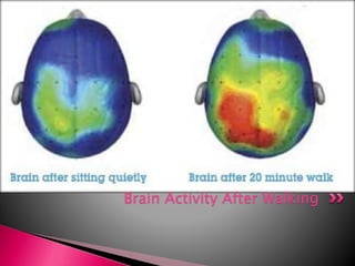 Brain Activity After Walking
 