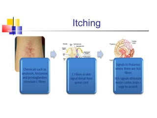 Itching
 