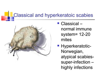 Classical and hyperkeratoic scabies
 Classical –
normal immune
system= 12-20
mites
 Hyperkeratotic-
Norwegian,
atypical scabies-
super-infection –
highly infections
 