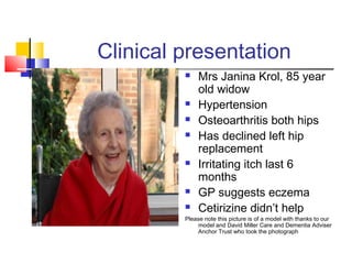 Clinical presentation
 Mrs Janina Krol, 85 year
old widow
 Hypertension
 Osteoarthritis both hips
 Has declined left hip
replacement
 Irritating itch last 6
months
 GP suggests eczema
 Cetirizine didn’t help
Please note this picture is of a model with thanks to our
model and David Miller Care and Dementia Adviser
Anchor Trust who took the photograph
 