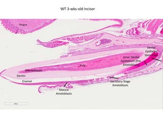 WT 3-wks-old incisor
Dental
Epithelial
Stem Cells
Inner Dental
Epithelium (Pre-
Ameloblasts)
Secretory Stage
Ameloblasts
Mature
Ameloblasts
Dentin
Odontoblasts
Pulp
Enamel
Tongue
 