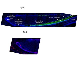 Tbx1
Epfn
Dental
Epithelial Stem
Cells
Inner Dental
Epithelium (Pre-
Ameloblasts)
Secretory Stage
Ameloblasts
Mature Ameloblasts
Enamel
Mature Odontoblasts
 