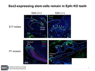 5
Sox2-expressing stem cells remain in Epfn KO teeth
Sox2
Epfn
DAPI
100nm
Sox2
DAPI
Epfn (-/-)Epfn (+/-)
P1 incisors
E17 molars
IDE
Cervical
loop
Dental
papilla
Cervical
loop
 