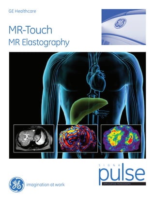 GE Healthcare
imagination at work
MR-Touch
MR Elastography
Application Monograph
pulse
S I G N A
 