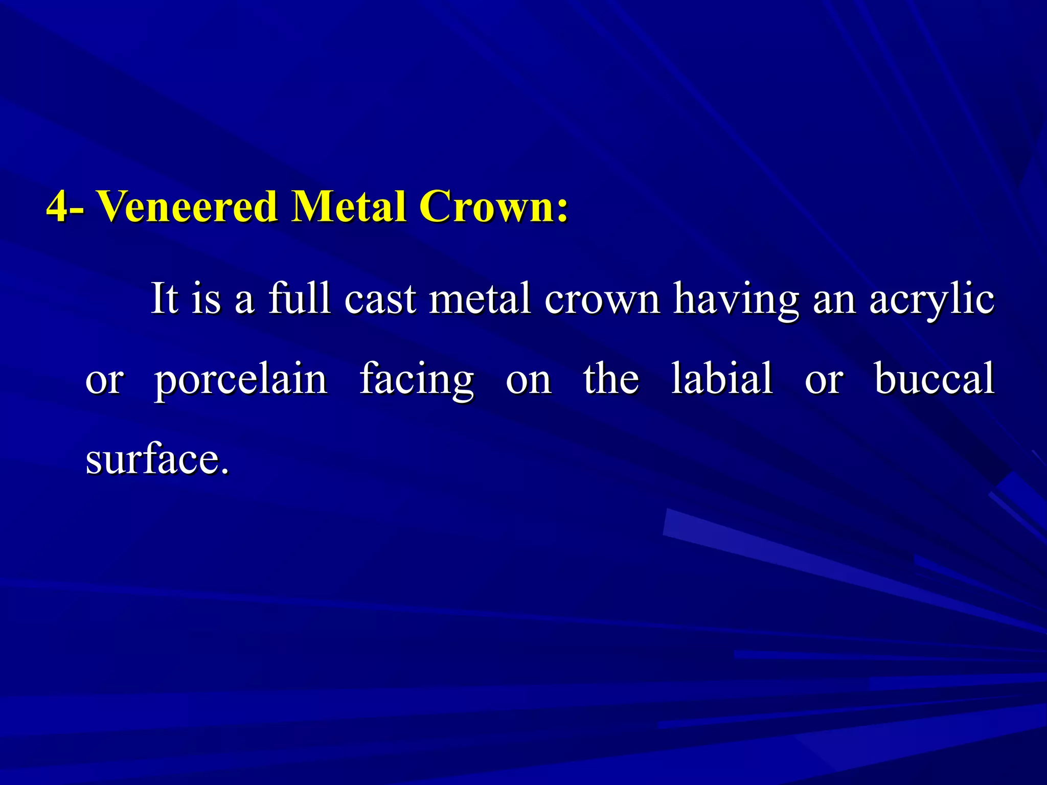 4- Veneered Metal Crown:4- Veneered Metal Crown:
It is a full cast metal crown having an acrylicIt is a full cast metal crown having an acrylic
or porcelain facing on the labial or buccalor porcelain facing on the labial or buccal
surface.surface.
 