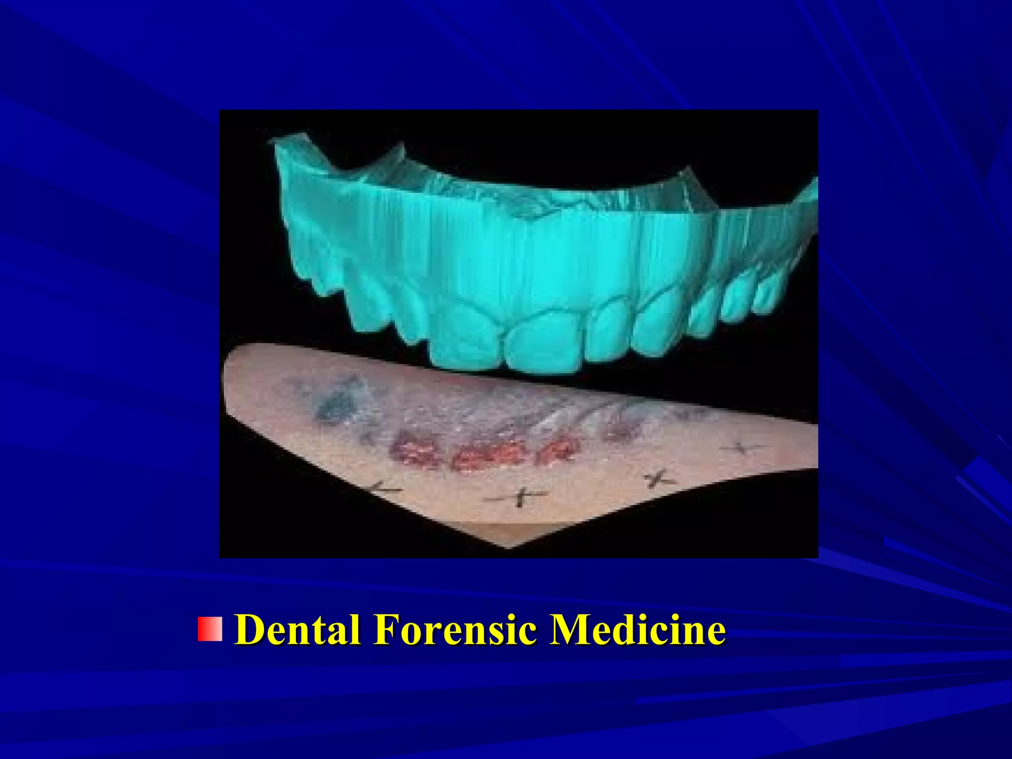 Dental Forensic MedicineDental Forensic Medicine
 