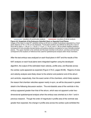 95
Figure 4.6: Snapshots of the Embryonic Zebrafish Heart on Separate Focal Planes
Images of the heart in a test WT zebrafish embryo at 55 hpf on multiple focal planes separated by a focal
plane distance of 18 ± 3.125 µm are displayed. Focal plane positions are defined as along the z axis at
(from left to right) z = -36 µm, z = -18 µm, z = 0 µm, z = 18 µm, and z = 36 µm where negative positions
correspond to more dorsally-oriented planes and positive positions correspond to more ventrally-oriented
planes. The upper chamber is the ventricle and the lower chamber is the atrium, and blue and red lines
correspond to the locations of reference lines used for spatiotemporal analysis within those chambers.
After the test embryo was analyzed on each focal plane in KAT and the results of the
KAT analysis on each focal plane were integrated together using the developed
algorithm, the output of the estimated mean velocity, profile area, and flowrate across
the cardiac cycle appeared as expected (Figure 4.7A-C, pages 95-96). Regions of area
and velocity analysis were likely closer to the anterior and posterior end of the atrium
and ventricle, respectively, than the exact center of the chambers, which likely explains
the reason that chamber velocities appear nearly in-sync, as will be discussed in greater
detail in the following discussion section. The end-diastolic area of the ventricle in this
embryo appeared greater than that of the atrium, which was not apparent under two-
dimensional spatiotemporal analysis when the embryo was oriented as in Aim 1 and in
previous research. Though the order of magnitude in profile area of the ventricle was
greater than expected, the change in profile area across the cardiac cycle exhibited the
 