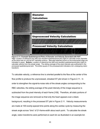 40
Figure 2.11: Example Spatiotemporal Plots of Diameter and Velocity Generated with KAT
Top: Location of reference line (left) and resultant spatiotemporal plot (right) to calculate lumen diameter
at the atrial inlet of a 48 hpf WT zebrafish embryo. Manually-selected points on the endocardial edge are
indicated in green. Bottom: Location of reference line (left) and resultant spatiotemporal plots (right) to
calculate velocity from the streak angle. The sliding average of the pixel intensity was subtracted in the
processed spatiotemporal plot. The white square in the processed plot indicates a bin undergoing radon
transform.
To calculate velocity, a reference line is oriented parallel to the flow at the center of the
flow profile to produce the unprocessed, streaked ST plot shown in Figure 2.11. In
order to strengthen the signal-to-noise ratio of the streak angles corresponding to the
RBC velocities, the sliding average of the pixel intensity of the image sequence is
subtracted from the pixel intensity of each frame [109]. Therefore, all static portions of
the image sequence are removed so that only the heart appears over a black
background, resulting in the processed ST plot in Figure 2.11. Velocity measurements
are made at 100 evenly-spaced time points along the cardiac cycle by measuring the
streak angle across “bins” of 21-frame-width about each point. To calculate the streak
angle, radon transforms were performed on each bin as illustrated in an example bin
 