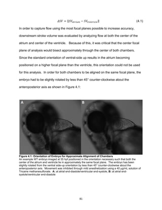 81
𝛥𝑆𝑉 = ‖𝑆𝑉𝐴𝑡𝑟𝑖𝑢𝑚 − 𝑆𝑉𝑉𝑒𝑛𝑡𝑟𝑖𝑐𝑙𝑒‖ (4.1)
In order to capture flow using the most focal planes possible to increase accuracy,
downstream stroke volume was evaluated by analyzing flow at both the center of the
atrium and center of the ventricle. Because of this, it was critical that the center focal
plane of analysis would bisect approximately through the center of both chambers.
Since the standard orientation of ventral-side up results in the atrium becoming
positioned on a higher focal plane than the ventricle, this orientation could not be used
for this analysis. In order for both chambers to be aligned on the same focal plane, the
embryo had to be slightly rotated by less than 45° counter-clockwise about the
anteroposterior axis as shown in Figure 4.1:
Figure 4.1: Orientation of Embryo for Approximate Alignment of Chambers
An example WT embryo imaged at 55 hpf positioned in the orientation necessary such that both the
center of the atrium and ventricle lie in approximately the same focal plane. The embryo has been
slightly rotated from the ventral side-up orientation by less than 45° counter-clockwise about the
anteroposterior axis. Movement was inhibited through mild anesthetization using a 40 µg/mL solution of
Tricaine methanesulfonate. A: at atrial end-diastole/ventricular end-systole, B: at atrial end-
systole/ventricular end-diastole
 