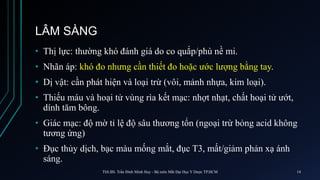 LÂM SÀNG
• Thị lực: thường khó đánh giá do co quắp/phù nề mi.
• Nhãn áp: khó đo nhưng cần thiết đo hoặc ước lượng bằng tay.
• Dị vật: cần phát hiện và loại trừ (vôi, mảnh nhựa, kim loại).
• Thiếu máu và hoại tử vùng rìa kết mạc: nhợt nhạt, chất hoại tử ướt,
dính tăm bông.
• Giác mạc: độ mờ tỉ lệ độ sâu thương tổn (ngoại trừ bỏng acid không
tương ứng)
• Đục thủy dịch, bạc màu mống mắt, đục T3, mất/giảm phản xạ ánh
sáng.
ThS.BS. Trần Đình Minh Huy - Bộ môn Mắt Đại Học Y Dược TP.HCM 14
 