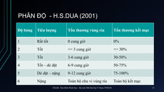 PHÂN ĐỘ - H.S.DUA (2001)
Độ bỏng Tiên lượng Tổn thương vùng rìa Tổn thương kết mạc
1 Rất tốt 0 cung giờ 0%
2 Tốt <= 3 cung giờ <= 30%
3 Tốt 3-6 cung giờ 30-50%
4 Tốt – dè dặt 6-9 cung giờ 50-75%
5 Dè dặt – nặng 9-12 cung giờ 75-100%
6 Nặng Toàn bộ chu vi vùng rìa Toàn bộ kết mạc
ThS.BS. Trần Đình Minh Huy - Bộ môn Mắt Đại Học Y Dược TP.HCM 15
 