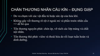 CHẤN THƯƠNG NHÃN CẦU KÍN – ĐỤNG GIẬP
• Do va chạm với các vật đầu tù hoặc sức ép của hỏa khí.
• Không gây vết thương rõ rệt ở ngoài mi và phần trước nhãn cầu
=> dễ bỏ qua
• Tổn thương nguyên phát: chèn ép, vỡ rách các lớp màng và chất
nội nhãn.
• Tổn thương thứ phát: viêm và thoái hóa do rối loạn tuần hoàn và
dinh dưỡng.
ThS.BS. Trần Đình Minh Huy - Bộ môn Mắt Đại Học Y Dược TP.HCM 29
 