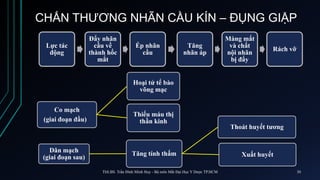 CHẤN THƯƠNG NHÃN CẦU KÍN – ĐỤNG GIẬP
Lực tác
động
Đẩy nhãn
cầu về
thành hốc
mắt
Ép nhãn
cầu
Tăng
nhãn áp
Màng mắt
và chất
nội nhãn
bị đẩy
Rách vỡ
Co mạch
(giai đoạn đầu)
Hoại tử tế bào
võng mạc
Thiếu máu thị
thần kinh
Dãn mạch
(giai đoạn sau)
Tăng tính thấm
Thoát huyết tương
Xuất huyết
ThS.BS. Trần Đình Minh Huy - Bộ môn Mắt Đại Học Y Dược TP.HCM 30
 