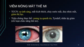 VIÊM MỐNG MẮT THỂ MI
• TCCN: sợ ánh sáng, mắt kích thích, chảy nước mắt, đau nhức mắt,
giảm thị lực.
• Triệu chứng thực thể: cương tụ quanh rìa, Tyndall, nhãn áp giảm
(rối loạn chức năng thể mi).
ThS.BS. Trần Đình Minh Huy - Bộ môn Mắt Đại Học Y Dược TP.HCM 34
 