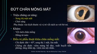 ĐỨT CHÂN MỐNG MẮT
• Triệu chứng cơ năng:
• Song thị một mắt
• Chói sáng
Phụ thuộc vào kích thước và vị trí vết rách so với bờ mi.
• Khám:
• Vết rách chân mống
• Đồng tử méo
• Điều trị phẫu thuật khâu chân mống mắt:
• Chỉ định: đứt > 450, song thị 1 mắt, lóa mắt.
• Chống chỉ định: viêm màng bồ đào, xuất huyết tiền
phòng, tăng nhãn áp, viêm mủ nội nhãn.
ThS.BS. Trần Đình Minh Huy - Bộ môn Mắt Đại Học Y Dược TP.HCM 42
 