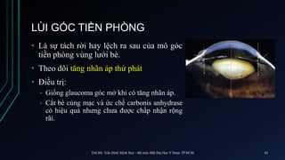 LÙI GÓC TIỀN PHÒNG
• Là sự tách rời hay lệch ra sau của mô góc
tiền phòng vùng lưới bè.
• Theo dõi tăng nhãn áp thứ phát
• Điều trị:
• Giống glaucoma góc mở khi có tăng nhãn áp.
• Cắt bè củng mạc và ức chế carbonis anhydrase
có hiệu quả nhưng chưa được chấp nhận rộng
rãi.
ThS.BS. Trần Đình Minh Huy - Bộ môn Mắt Đại Học Y Dược TP.HCM 43
 
