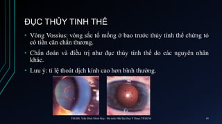 ĐỤC THỦY TINH THỂ
• Vòng Vossius: vòng sắc tố mống ở bao trước thủy tinh thể chứng tỏ
có tiền căn chấn thương.
• Chẩn đoán và điều trị như đục thủy tinh thể do các nguyên nhân
khác.
• Lưu ý: tỉ lệ thoát dịch kính cao hơn bình thường.
ThS.BS. Trần Đình Minh Huy - Bộ môn Mắt Đại Học Y Dược TP.HCM 45
 