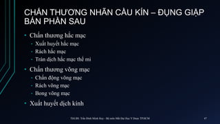• Chấn thương hắc mạc
• Xuất huyết hắc mạc
• Rách hắc mạc
• Tràn dịch hắc mạc thể mi
• Chấn thương võng mạc
• Chấn động võng mạc
• Rách võng mạc
• Bong võng mạc
• Xuất huyết dịch kính
CHẤN THƯƠNG NHÃN CẦU KÍN – ĐỤNG GIẬP
BÁN PHẦN SAU
ThS.BS. Trần Đình Minh Huy - Bộ môn Mắt Đại Học Y Dược TP.HCM 47
 