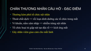 CHẤN THƯƠNG NHÃN CẦU HỞ - ĐẶC ĐIỂM
• Thường kèm phòi tổ chức nội nhãn
• Thoát chất dịch => rối loạn dinh dưỡng các tổ chức trong mắt
• Vi khuẩn, nấm xâm nhập => nhiễm trùng nội nhãn
• Tổ chức hoại tử giập nát tạo độc tố => kích ứng mắt
• Gây nhãn viêm giao cảm cho mắt lành
ThS.BS. Trần Đình Minh Huy - Bộ môn Mắt Đại Học Y Dược TP.HCM 58
 