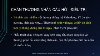 CHẤN THƯƠNG NHÃN CẦU HỞ - ĐIỀU TRỊ
• Bỏ nhãn cầu thì đầu: vết thương không thể khâu được, ST (-), rách
cực sau, nhãn cầu xẹp,… Thường trì hoãn vài ngày để BN ổn định
tâm lý nhưng không quá 14 ngày (nhãn viêm giao cảm)
• Phẫu thuật khâu vết rách: càng sớm càng tốt, nhằm đóng kín vết
thương, phục hồi chức năng nhãn cầu, hạn chế phòi tổ chức nội nhãn
và nhiễm trùng.
ThS.BS. Trần Đình Minh Huy - Bộ môn Mắt Đại Học Y Dược TP.HCM 61
 