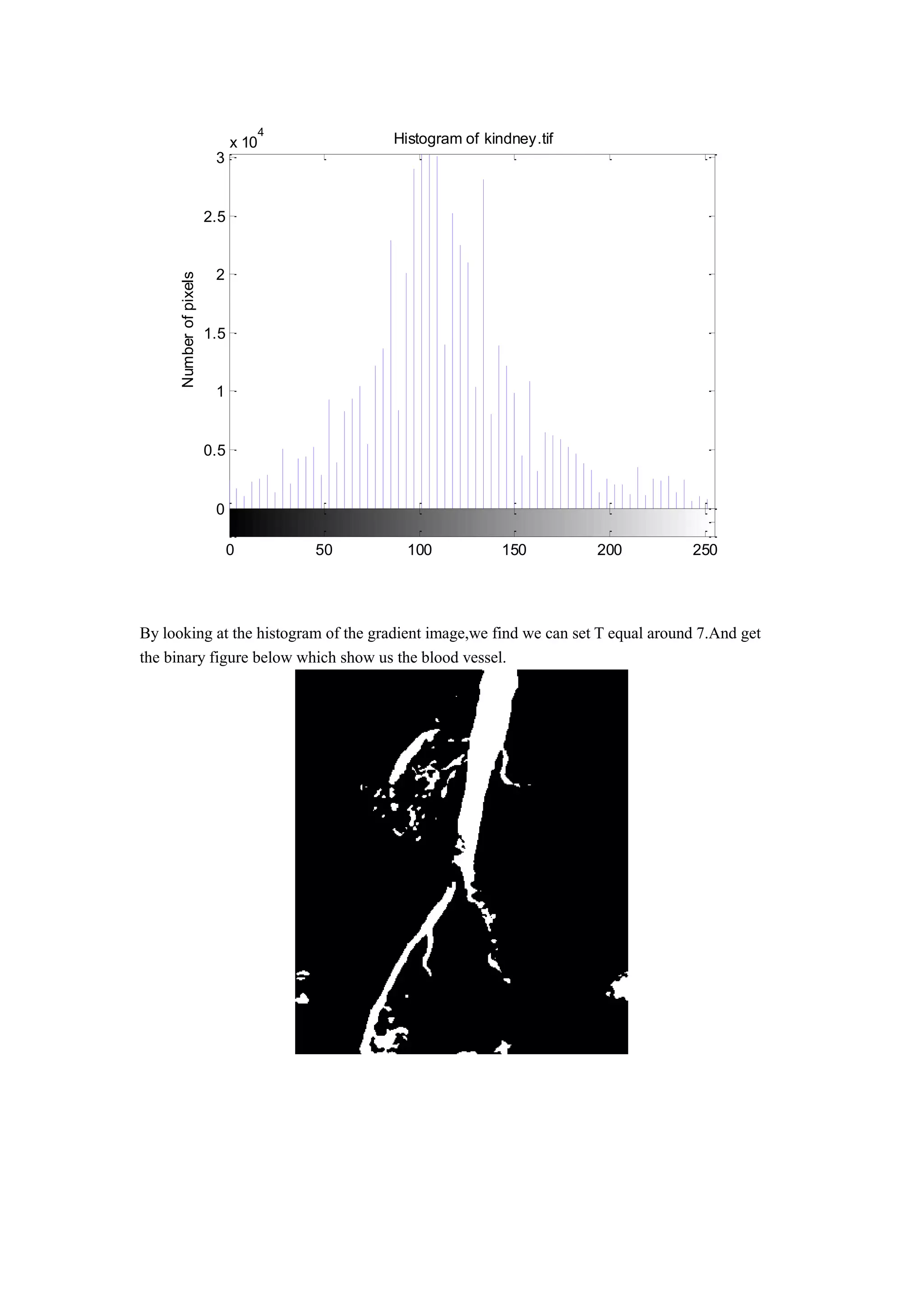 By looking at the histogram of the gradient image,we find we can set T equal around 7.And get
the binary figure below which show us the blood vessel.
0
0.5
1
1.5
2
2.5
3
x 10
4
Histogram of kindney.tif
Intensity level
Numberofpixels
0 50 100 150 200 250
 