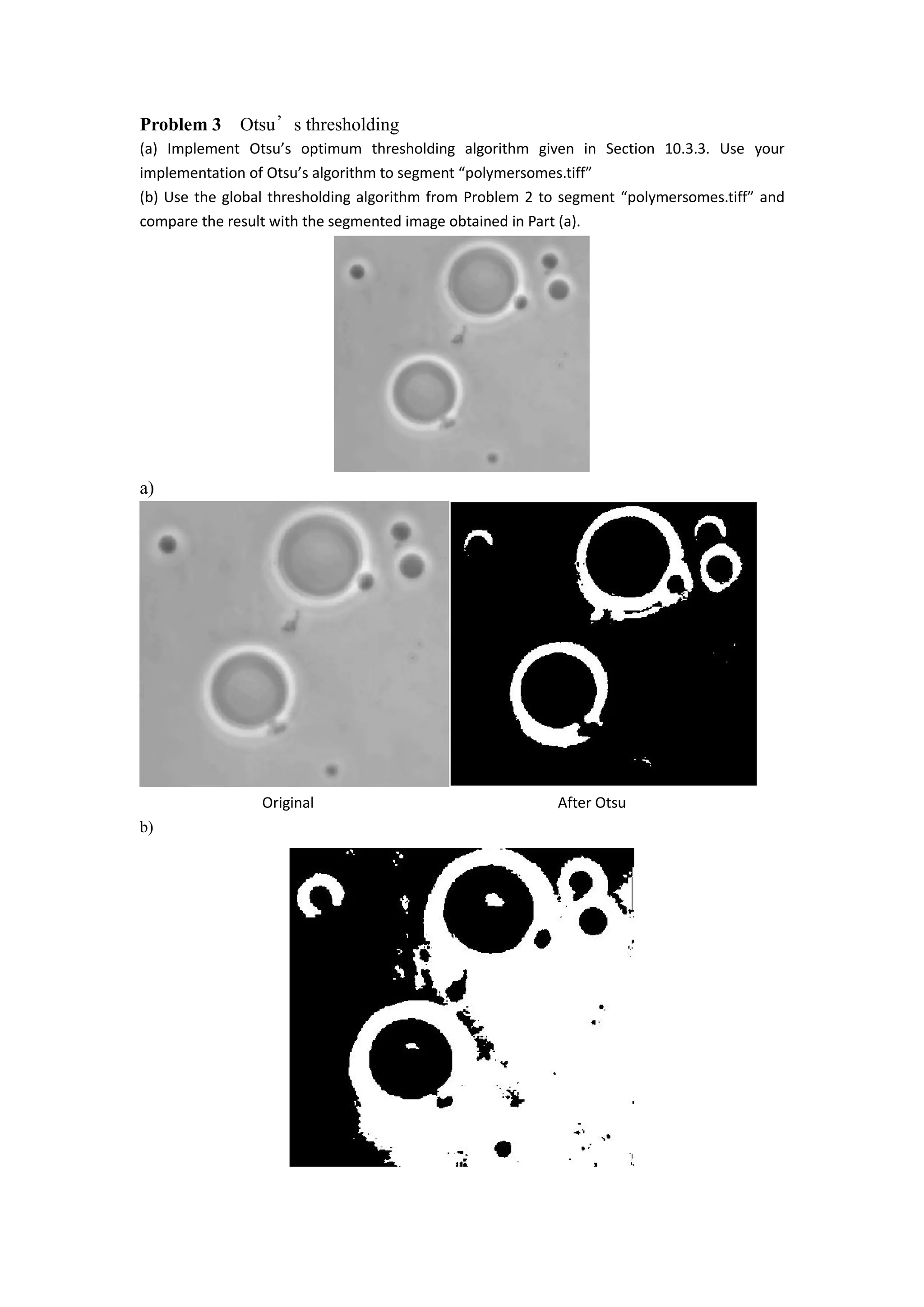 Problem 3 Otsu’s thresholding
(a) Implement Otsu’s optimum thresholding algorithm given in Section 10.3.3. Use your
implementation of Otsu’s algorithm to segment “polymersomes.tiff”
(b) Use the global thresholding algorithm from Problem 2 to segment “polymersomes.tiff” and
compare the result with the segmented image obtained in Part (a).
a)
Original After Otsu
b)
 