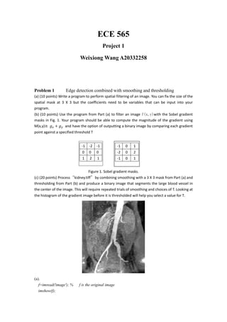 ECE 565
Project 1
Weixiong Wang A20332258
Problem 1 Edge detection combined with smoothing and thresholding
(a) (10 points) Write a program to perform spatial filtering of an image. You can fix the size of the
spatial mask at 3 X 3 but the coefficients need to be variables that can be input into your
program.
(b) (10 points) Use the program from Part (a) to filter an image f(x,y)with the Sobel gradient
masks in Fig. 1. Your program should be able to compute the magnitude of the gradient using
M(x,y) + and have the option of outputting a binary image by comparing each gradient
point against a specified threshold T
Figure 1. Sobel gradient masks.
(c) (20 points) Processkidney.tiffby combining smoothing with a 3 X 3 mask from Part (a) and
thresholding from Part (b) and produce a binary image that segments the large blood vessel in
the center of the image. This will require repeated trials of smoothing and choices of T. Looking at
the histogram of the gradient image before it is thresholded will help you select a value for T.
(a).
f=imread('image'); % f is the original image
imshow(f);
-1 0 1
-2 0 2
-1 0 1
-1 -2 -1
0 0 0
1 2 1