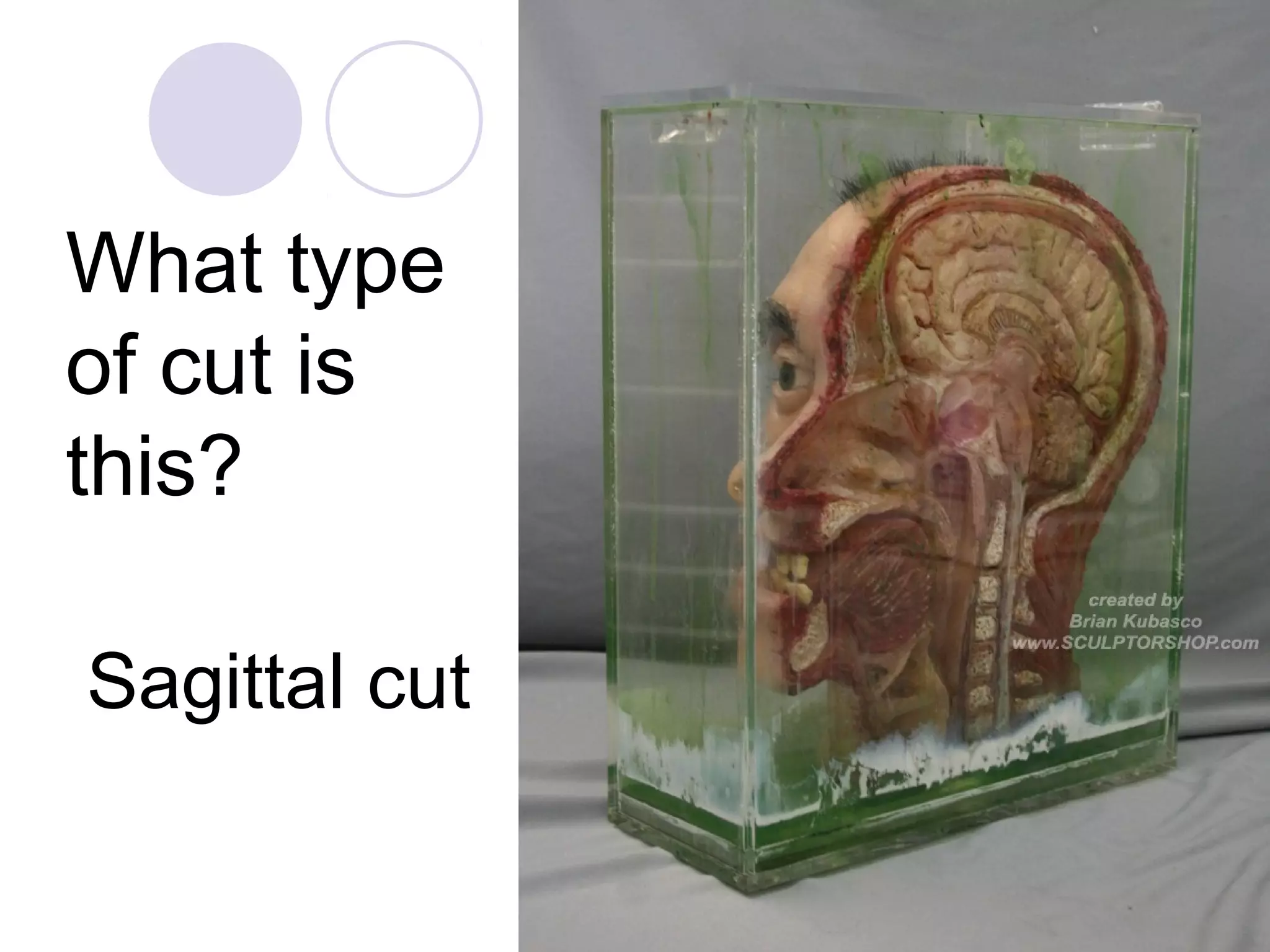 What type
of cut is
this?
Sagittal cut
 